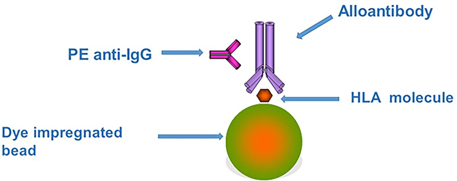 Principles underlying the HLA single antigen bead assay.